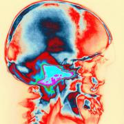 El lenguaje y el cerebro